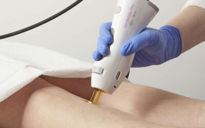 Laser Hair Removal at Center for Aesthetics in Idaho Falls: Say Goodbye to Unwanted Hair